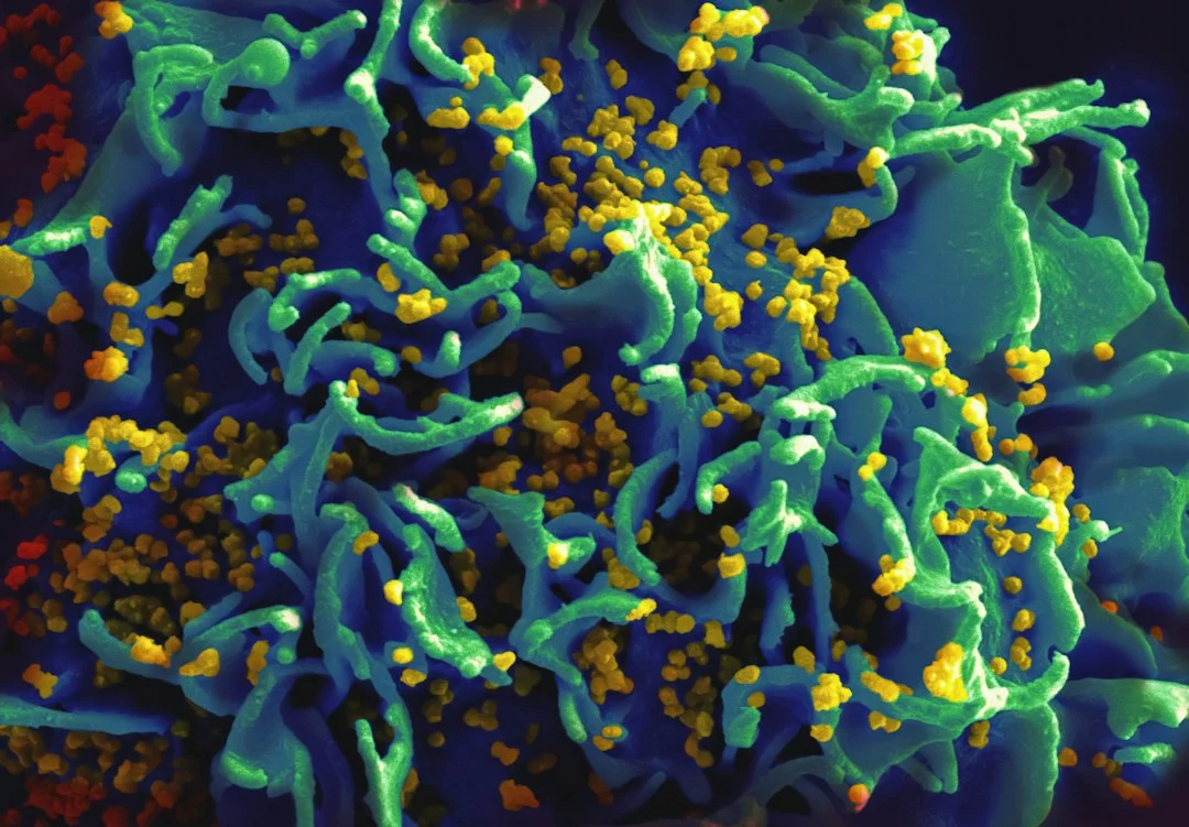 Alcohol Impairs Gut Autophagy Leading to Barrier Breakdown