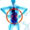 Can fecal transplants slow ALS decline?