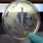 Can gut microbiome tests forecast multiple sclerosis course?