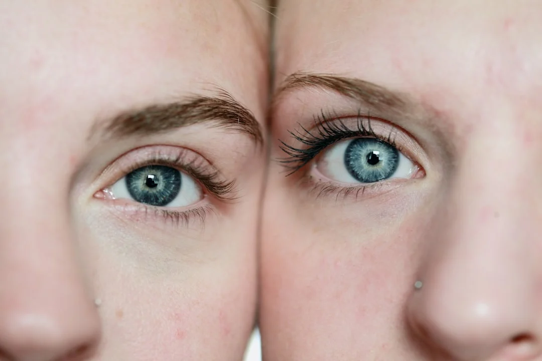 How multi‑ancestry GWAS can personalize dry‑eye prevention