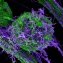 How nanomedicine can reprogram the cancer immunometabolic niche