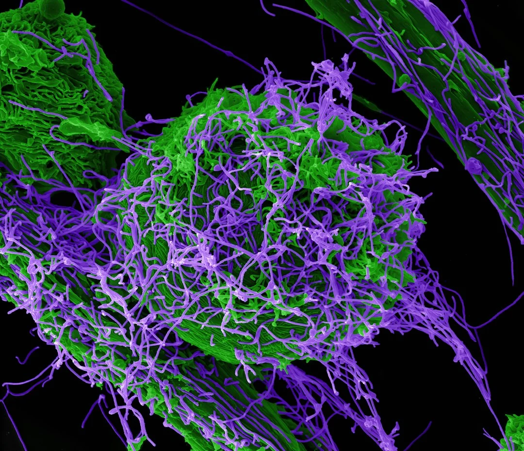 How nanomedicine can reprogram the cancer immunometabolic niche for