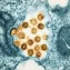 Microbiome test for early multiple sclerosis detection
