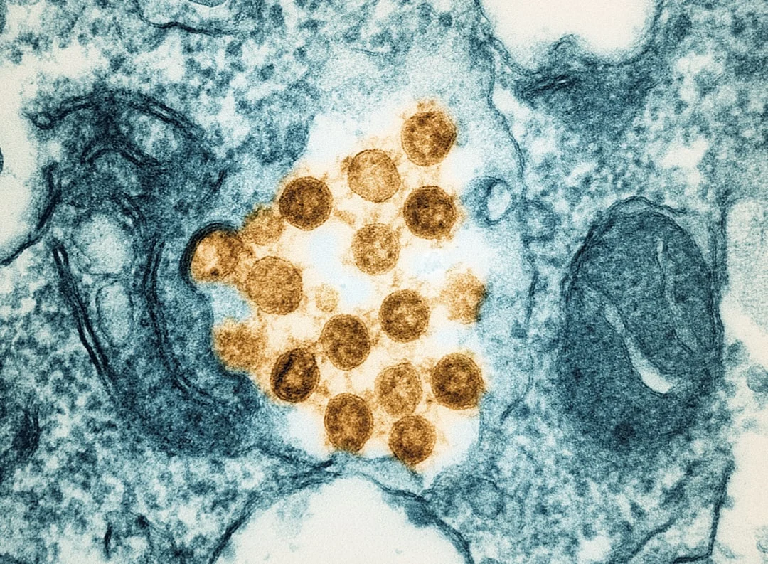 Microbiome test for early multiple sclerosis detection