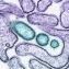 Persistent Interferon Drives Viremia in Severe COVID-19 Patients
