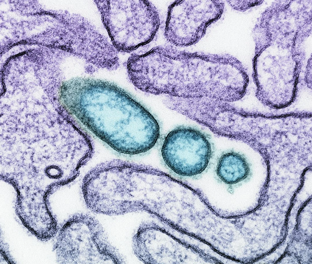 Persistent Interferon Drives Viremia in Severe COVID-19 Patients