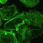 Plasma neurofilament light as early neurodegeneration marker