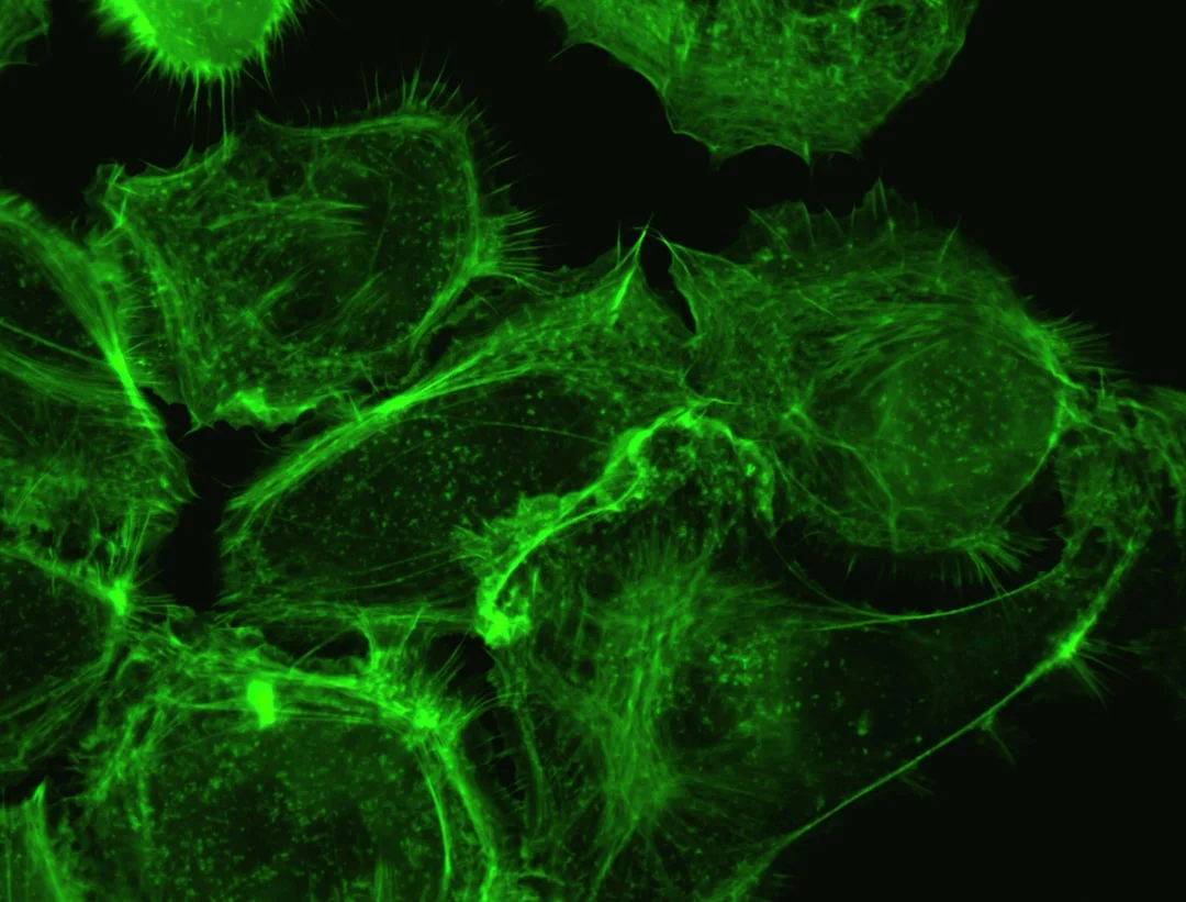 Plasma neurofilament light as early neurodegeneration marker