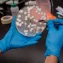 What gut-microbiome profiling reveals for personalized ALS risk