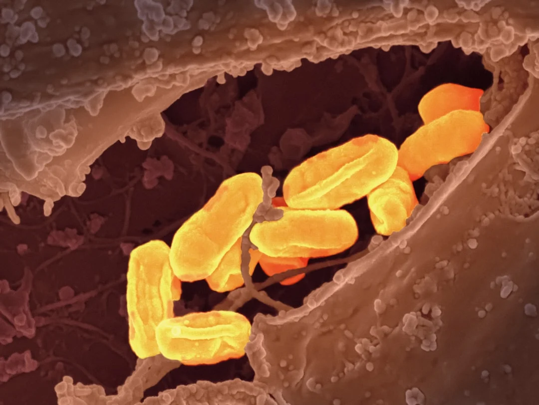 Will gut‑microbiome profiling become a longevity biomarker?